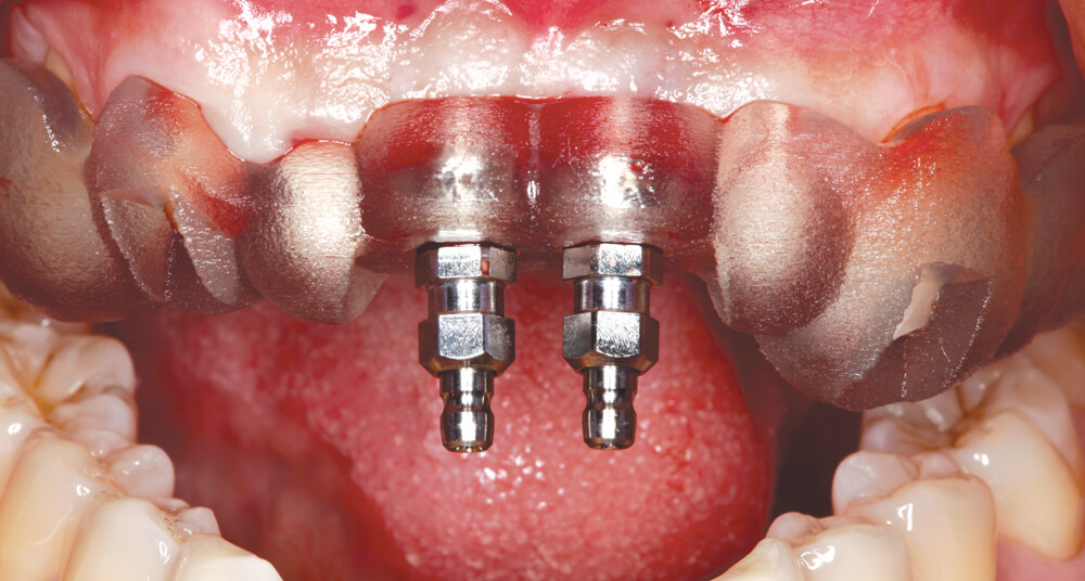 Facial Trauma Facial Trauma