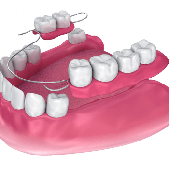 Dentures Post Op Dentures Post Op